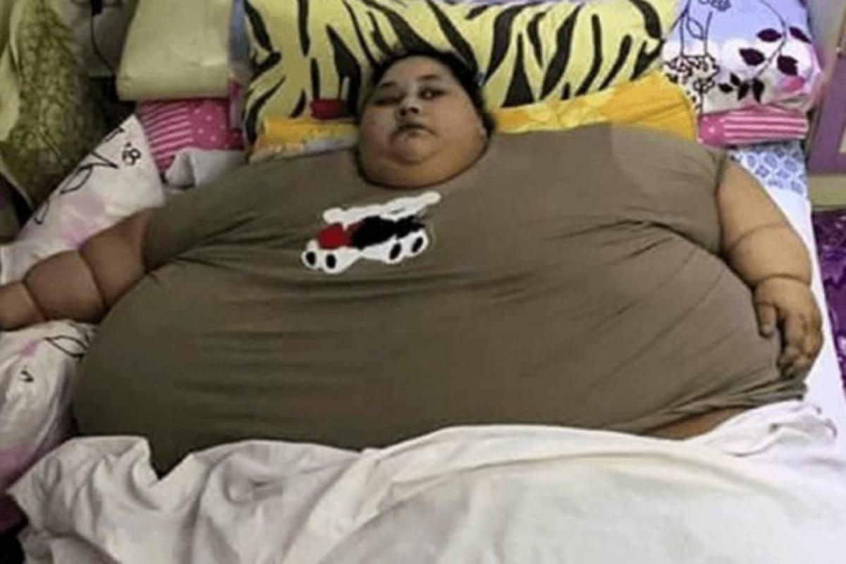 500-Kg Egyptian Woman To Reach Mumbai Today For Surgery