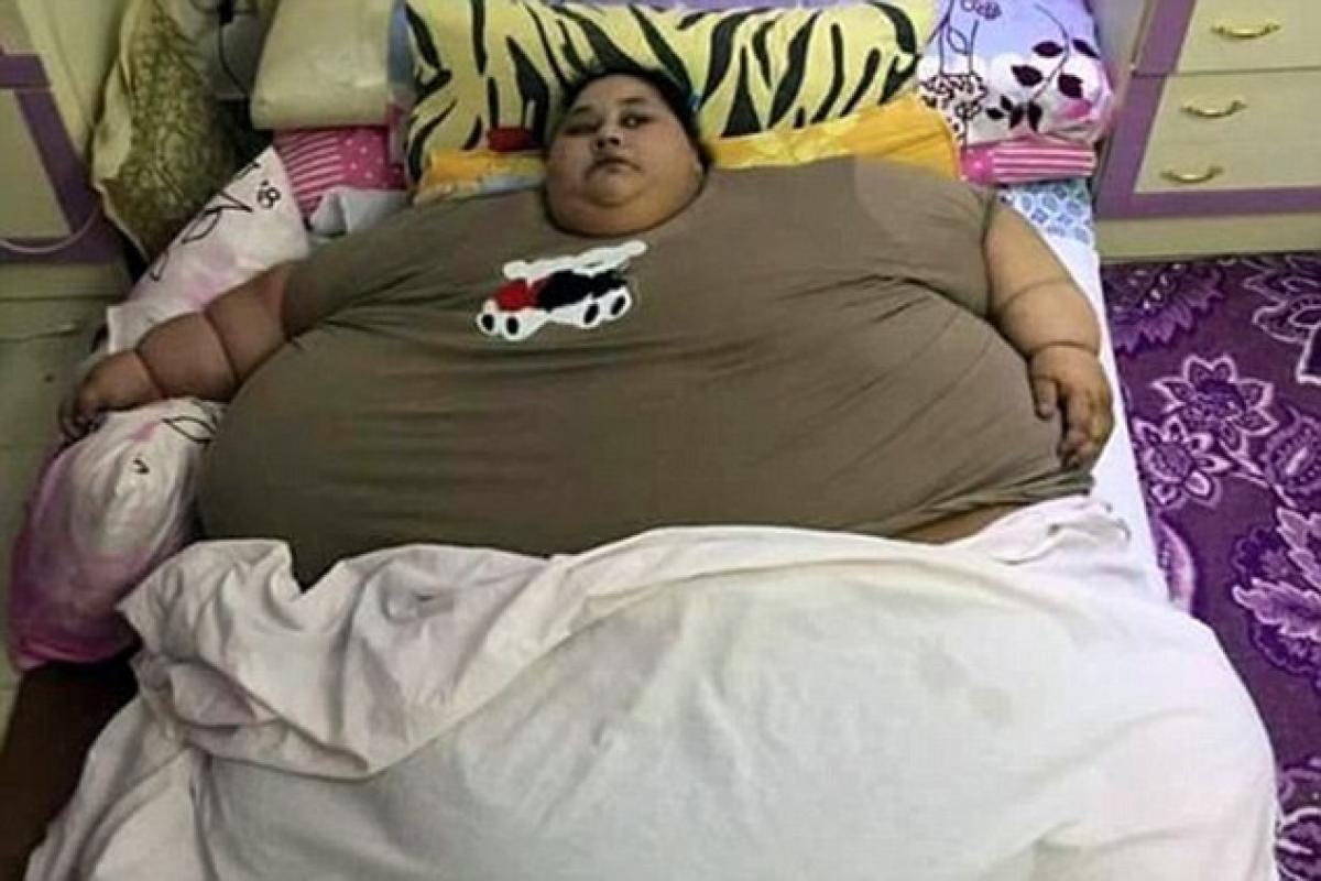 Worlds heaviest woman in process to lose the tag, reduces 100kg ahead of surgery