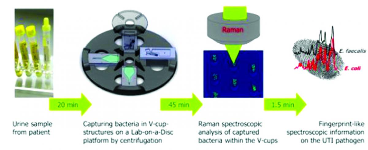 New device detects urinary tract infections in an hour