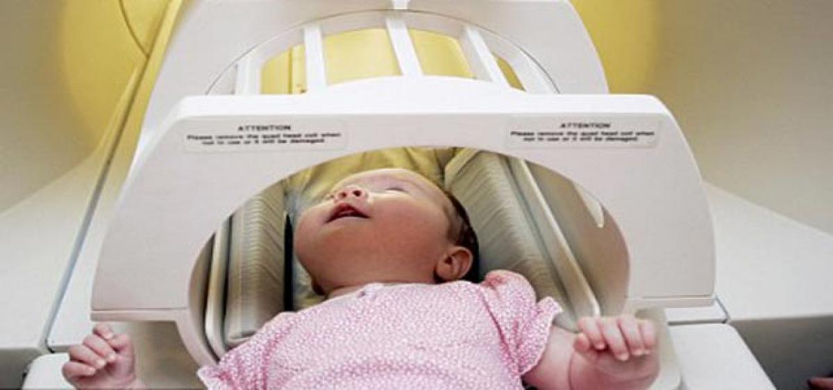 MRI scans can predict babies at risk of autism