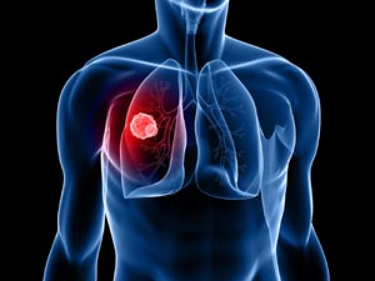 Protein key to combating lung cancer identified