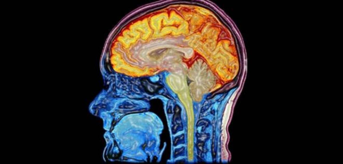 Fat build-up in brain may trigger Alzheimers disease