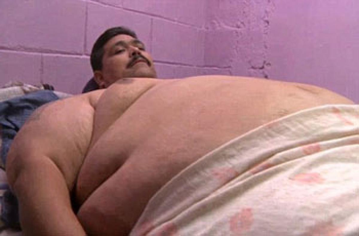 Most obese man dies of heart failure