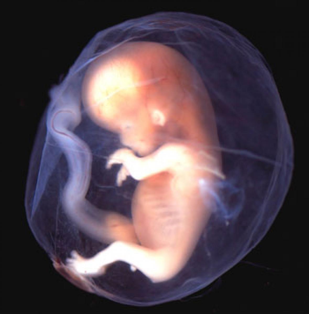 New 3D software tracks embryos brain development
