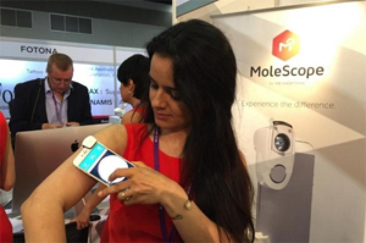 Simple smartphone device to catch skin cancer early