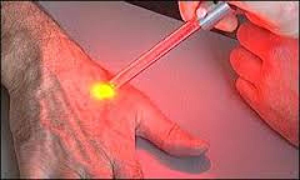 Laser Treatment of Cancer! A new hope for patients
