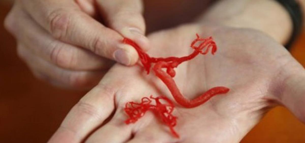 3D-printed, lifelike blood vessel network created