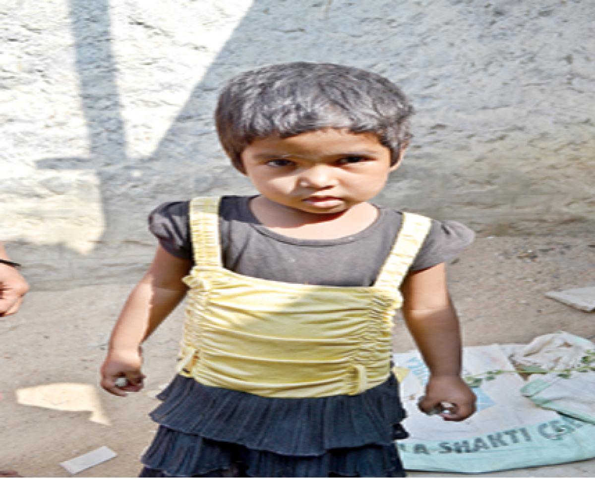 3-yr-old suffers burns at Anganwadi