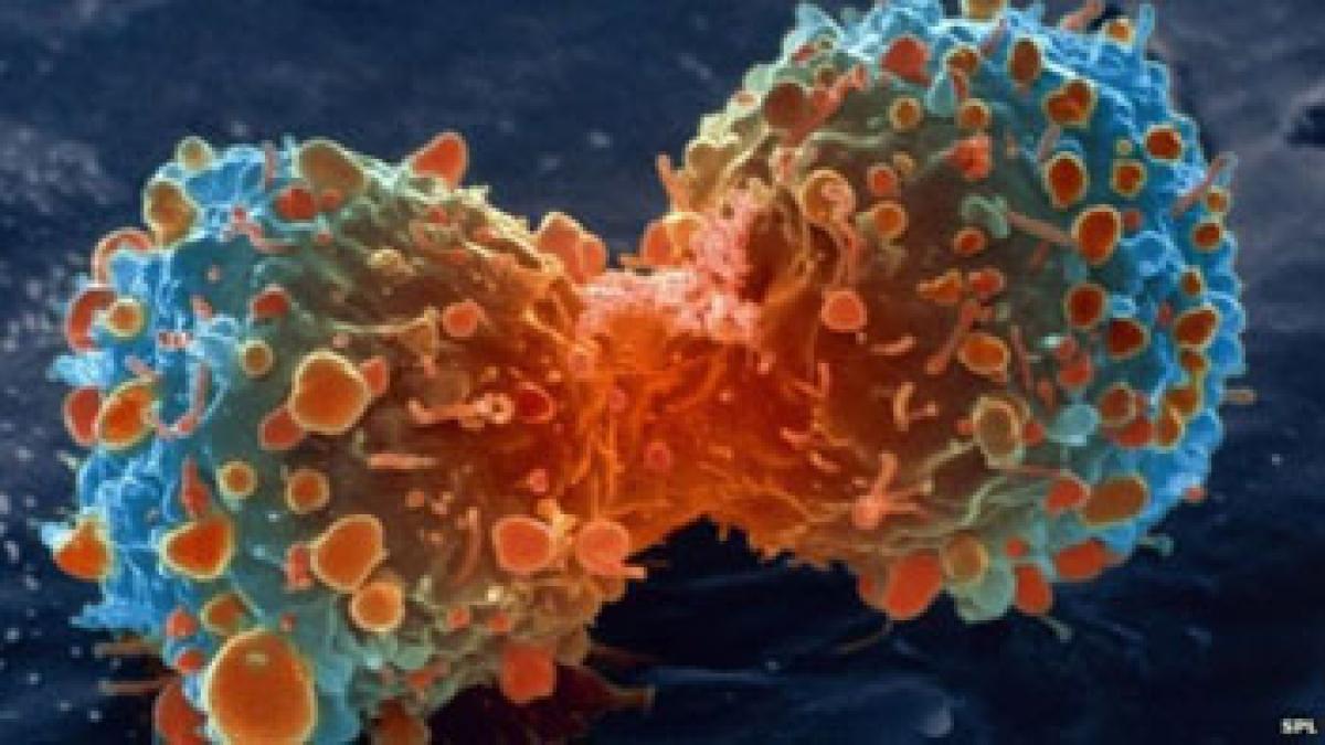 Another contagious form of cancer discovered