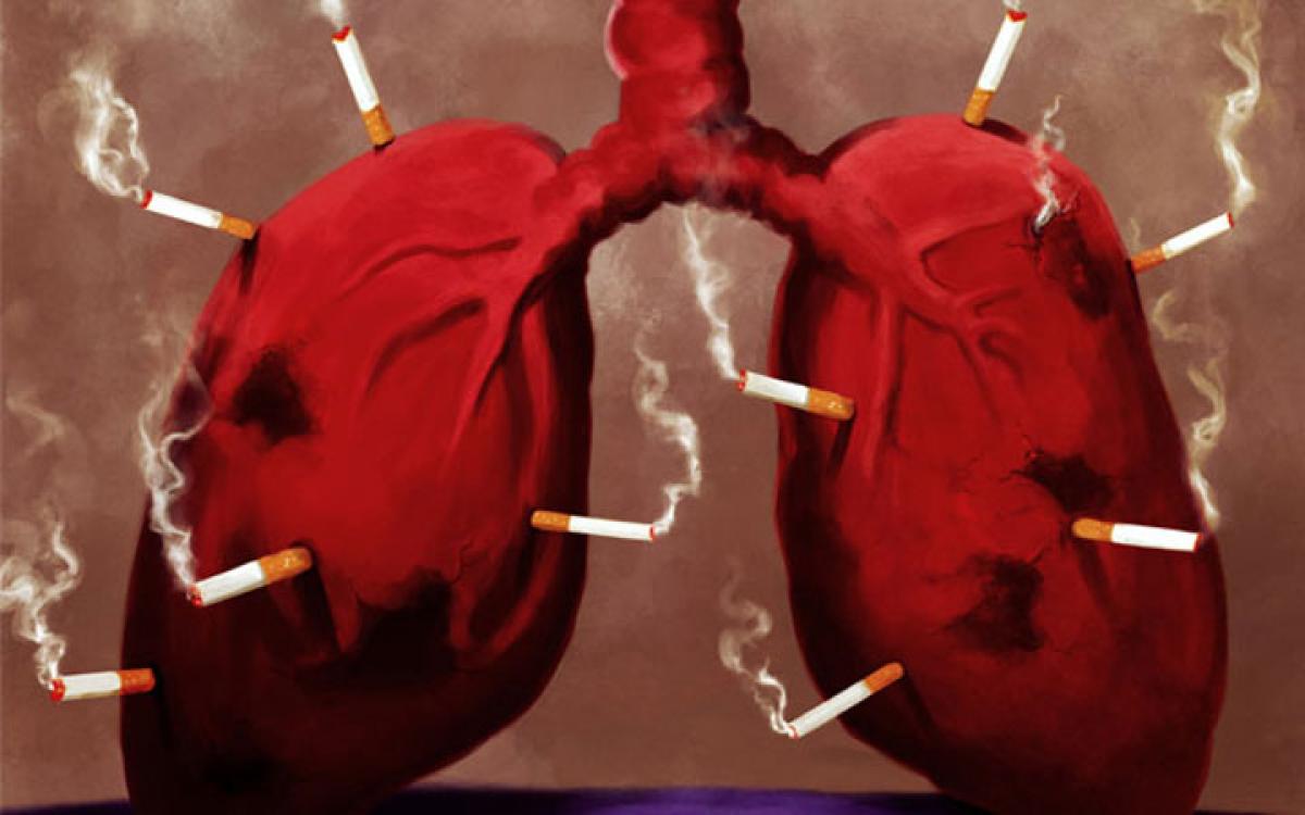 Lung cancer risk for smokers remains high even years after kicking the butt