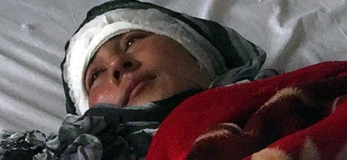 Afghan woman mutilated by husband seeks treatment abroad