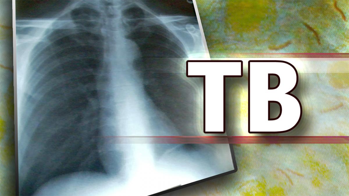 Telangana Collector blames exclusion of beef for rise in tuberculosis cases