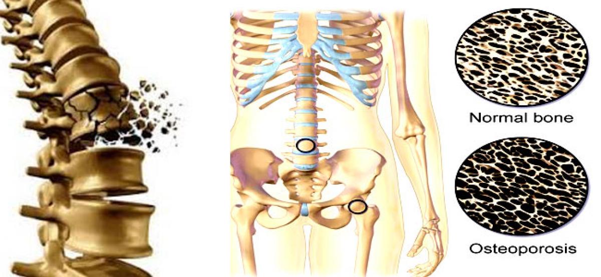 Air pollution causes weak bones, fractures