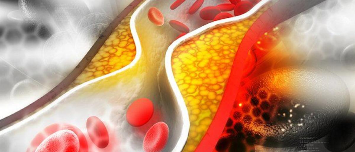Can managing cholesterol reduce Alzheimer’s risk?