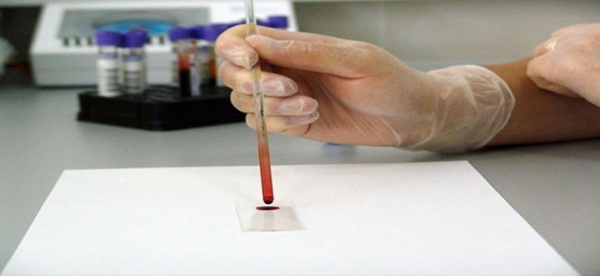 Blood tests can predict treatment for advanced prostate cancer