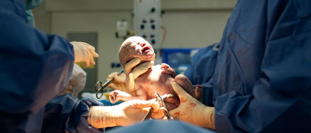 SC junks plea on cesarean deliveries