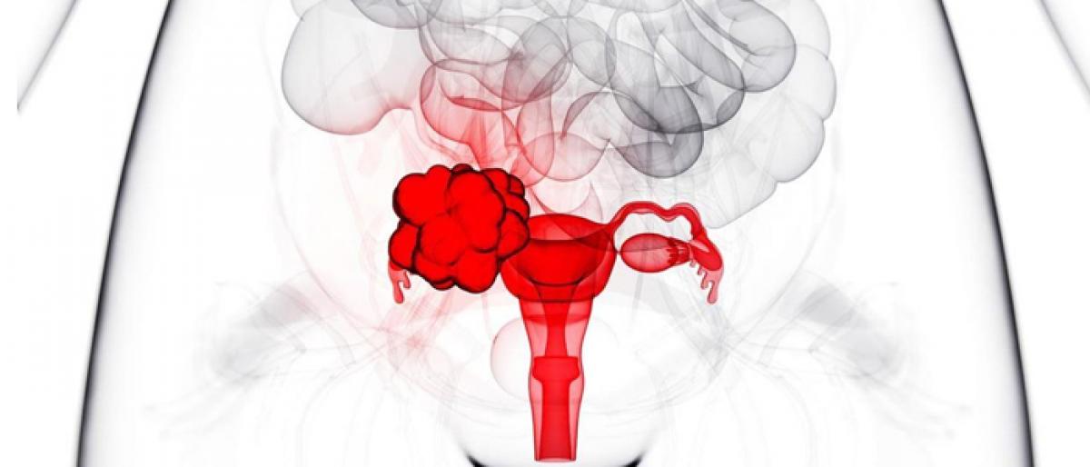 New birth control pills may cut ovarian cancer risk
