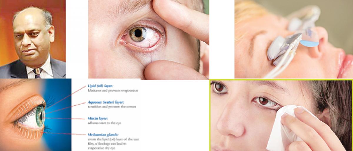 Know all about ‘Dry Eye Syndrome’