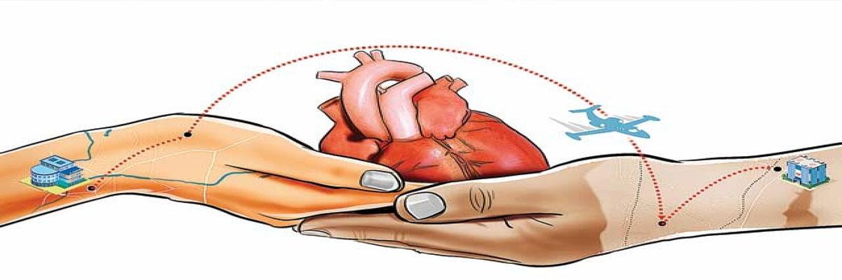 City doctors perform rare heart transplant