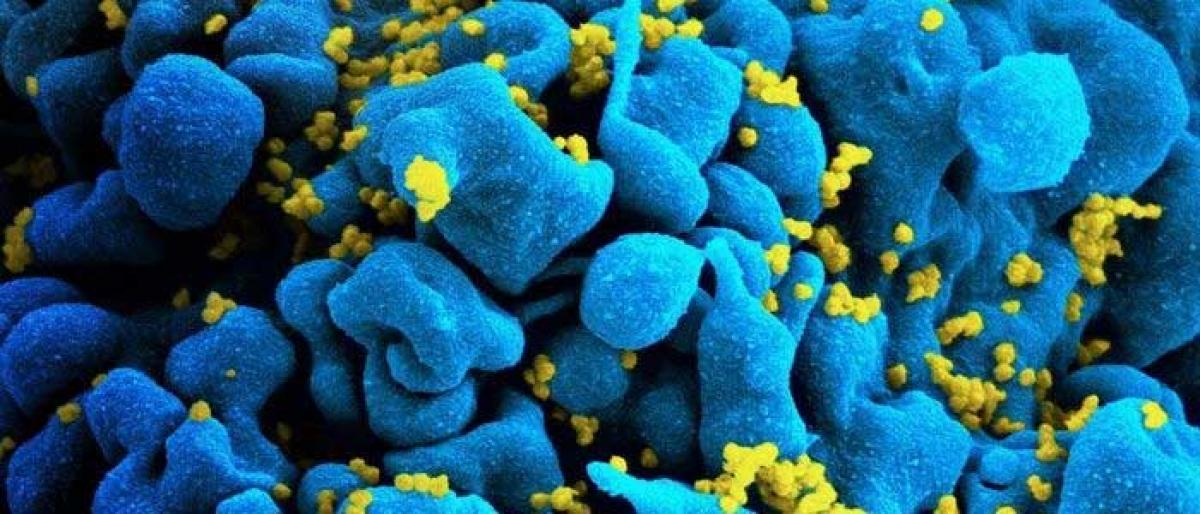 Researchers identify potential new way to treat HIV