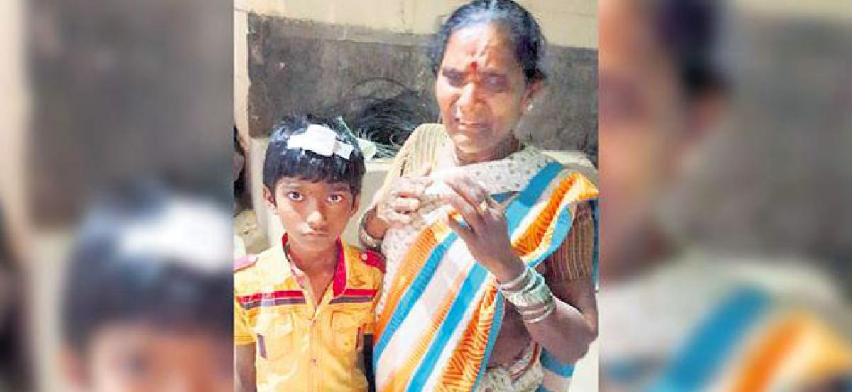 Hyderabad: Class 4 boy beaten up with duster by teacher, suffers head injury