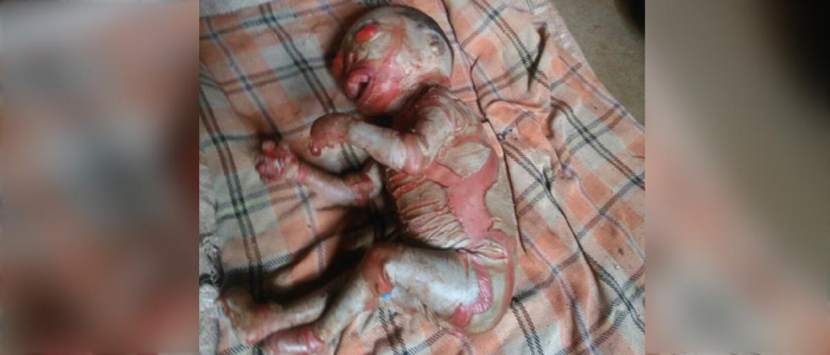 Baby born with abnormal features in Atmakur