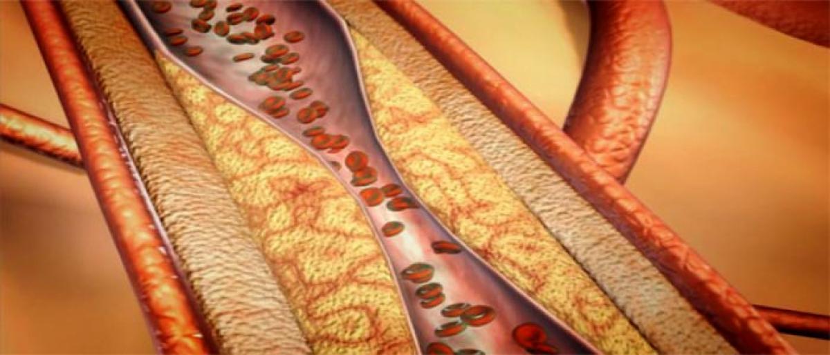 Non-surgical management of coronary artery disease
