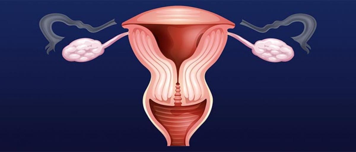 Ovarian cancers originate in fallopian tubes: Study