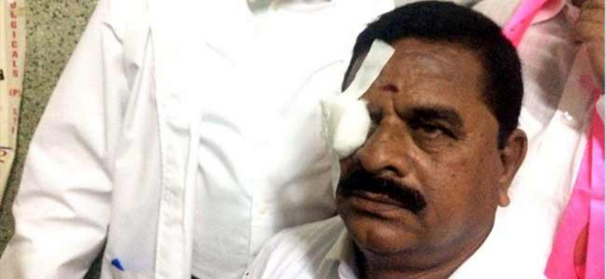 Council Chairman suffers eye injury by headphone thrown by Congress MLAs