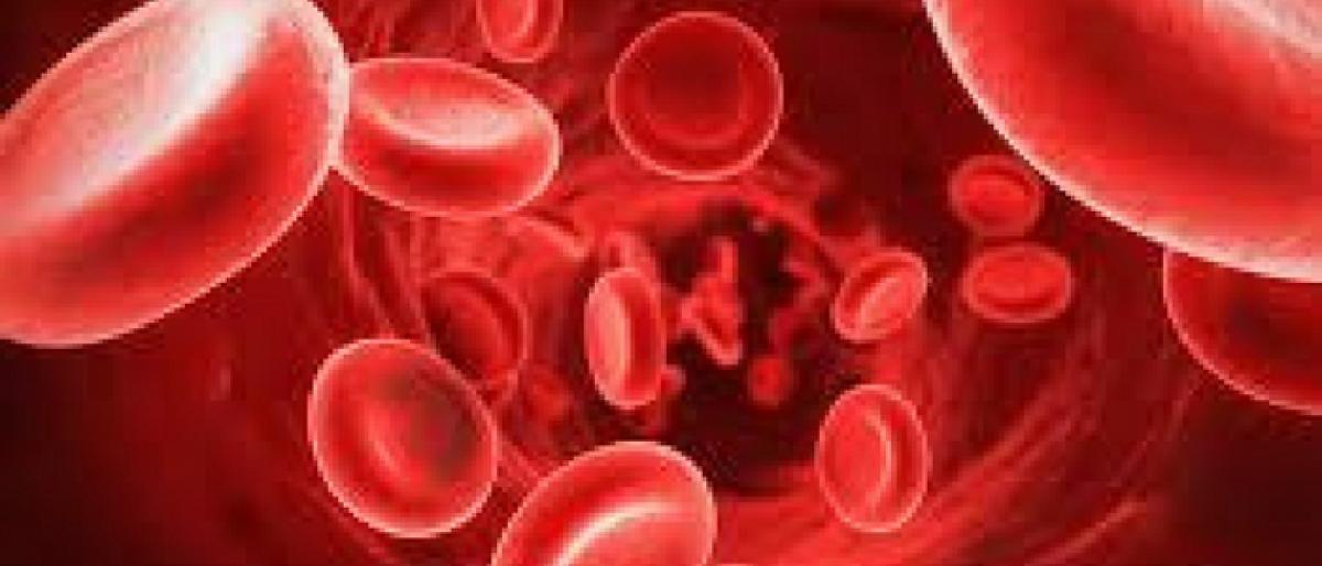 Society to intensify Thalassemia awareness campaign