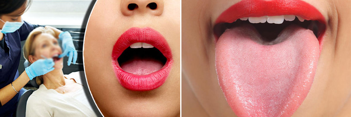 Tongue gives out the most important message about your Health