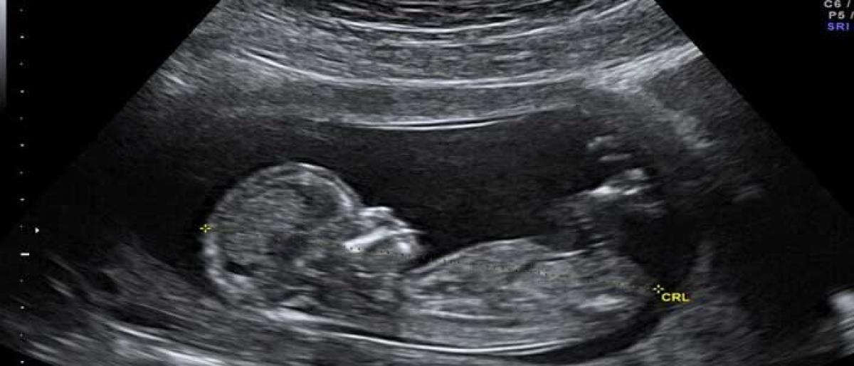 Ultrasound scan & its effect on babies