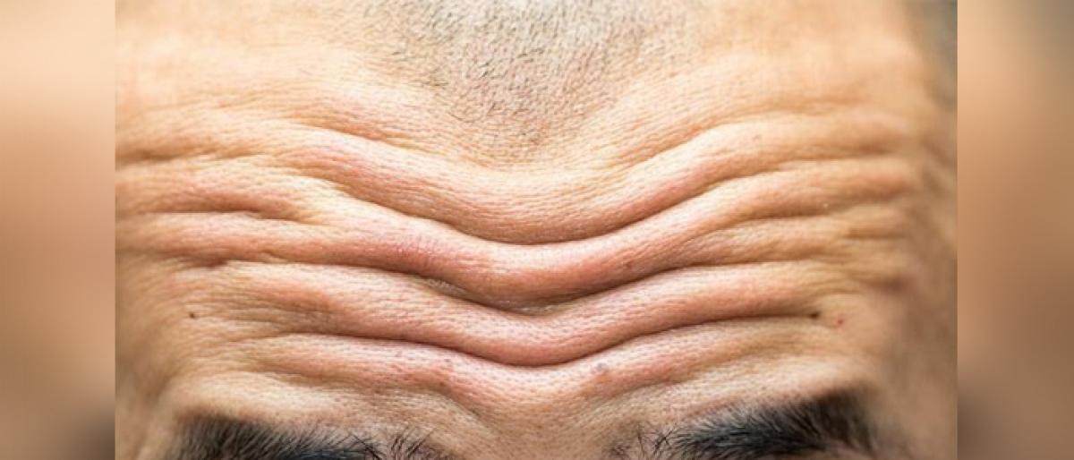 Your forehead wrinkles may predict cardiovascular death risk