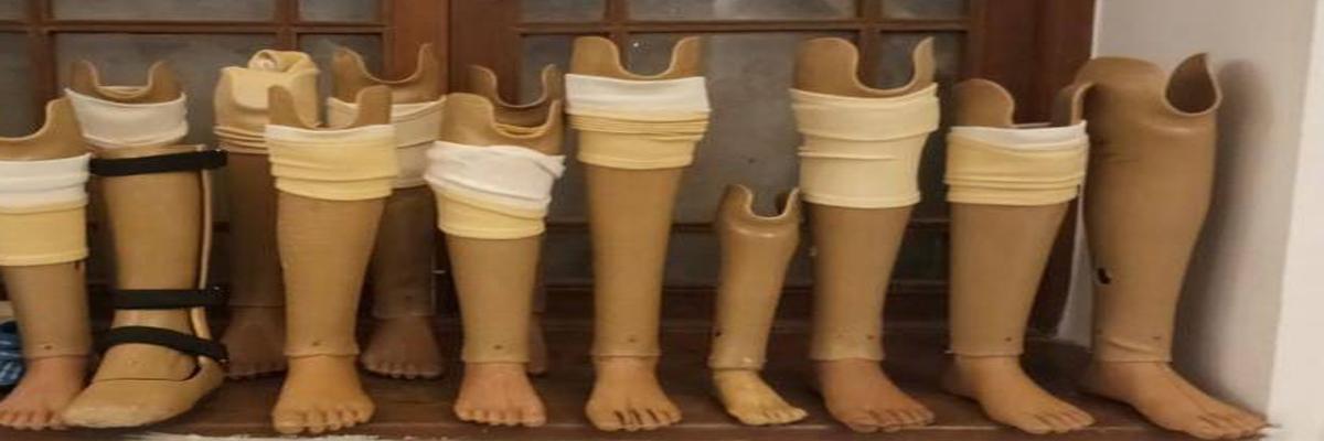 Measurement camp in Nellore to provide artificial limbs
