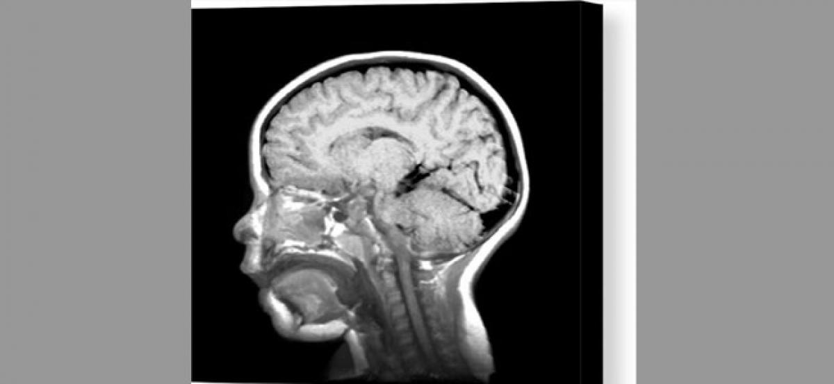 Post stroke, babies use opposite side of brain for language