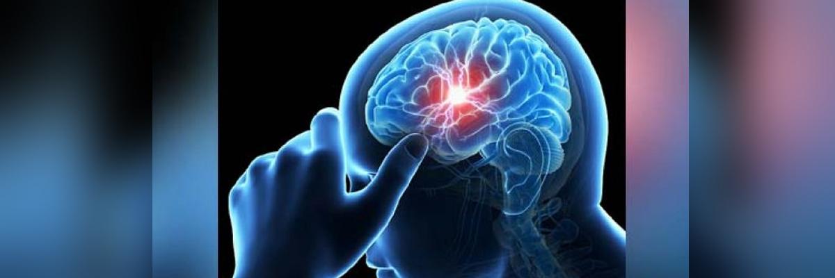 AI system learns to diagnose, classify intracranial haemorrhage