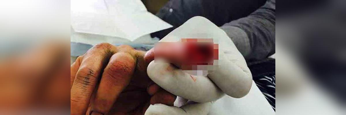 Man chops off finger after the defeat of his favourite leader in Telangana elections