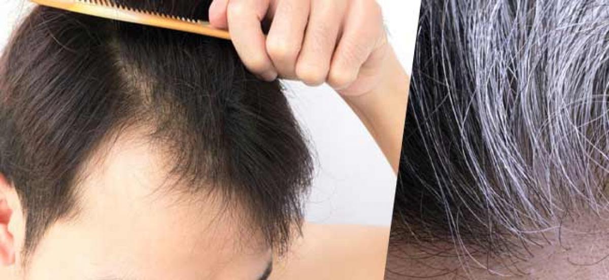 New gene for rare genetic hair loss discovered