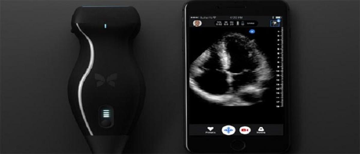 This iPhone-based  ultrasound machine  can detect cancer