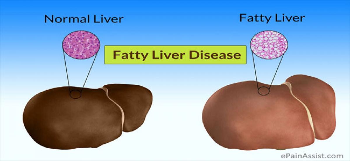 Ways to lower fatty liver disease