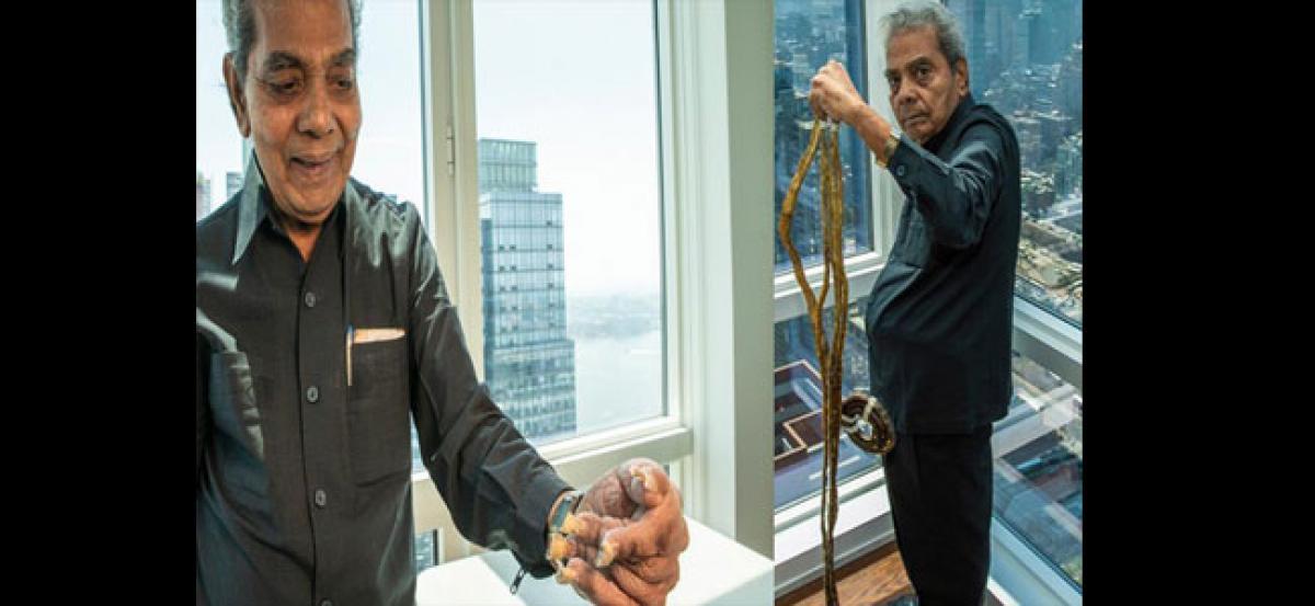 Man with world's longest nails cuts them after 66 years