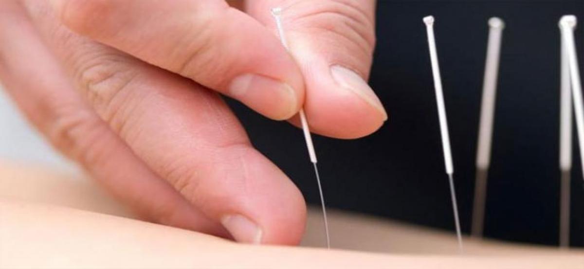 Acupuncture may boost chances of pregnancy through IVF