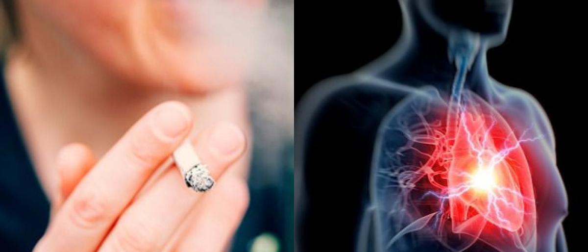Heart attack risk high for women who smoke: Study