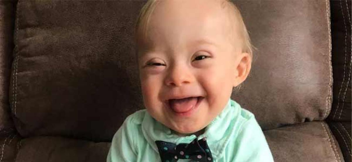In a first, Gerber names boy with Down syndrome Spokesbaby