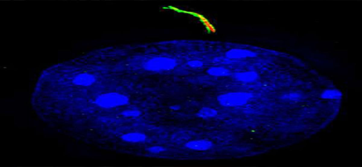 US study finds cellular antennae cilia boosts fat formation